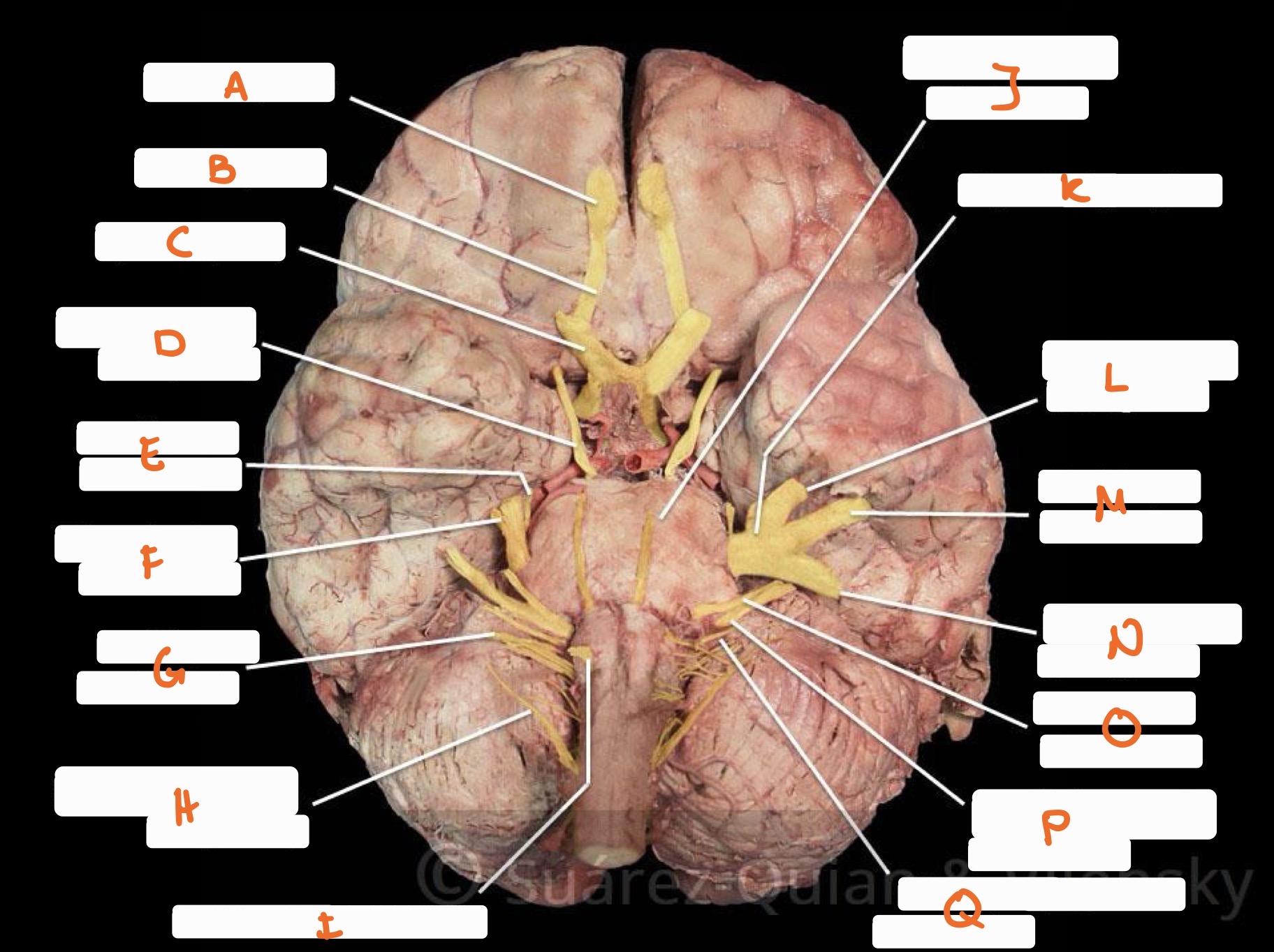 knowt flashcard image