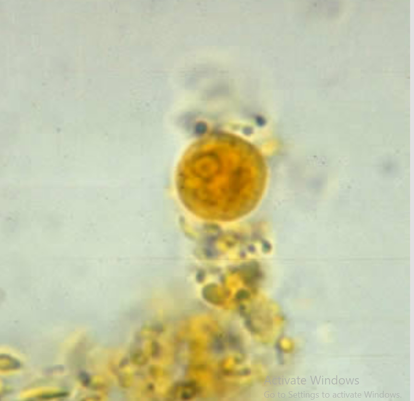 <ol><li><p>Entamoeba hartmanni</p></li><li><p>Small race of E. histolytica</p></li><li><p>Cyst</p></li></ol><p></p>