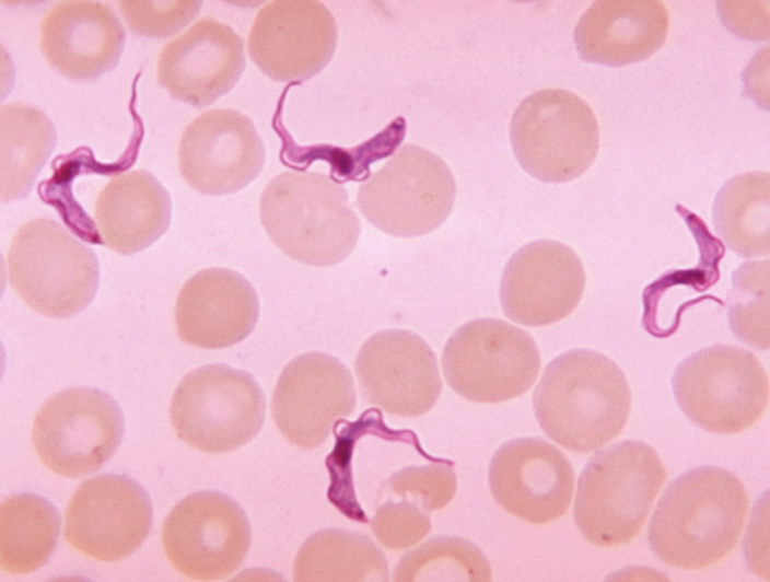 <p>What protists is this? (genus name)</p>