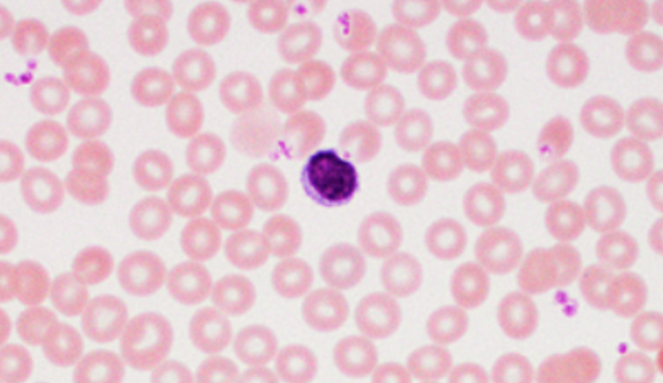<p>ID white blood cells</p>