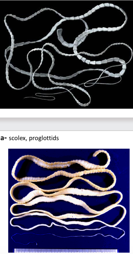 <p>name the <strong>genus</strong> that causes the <u>cow tapeworm </u>infection?</p><p></p>