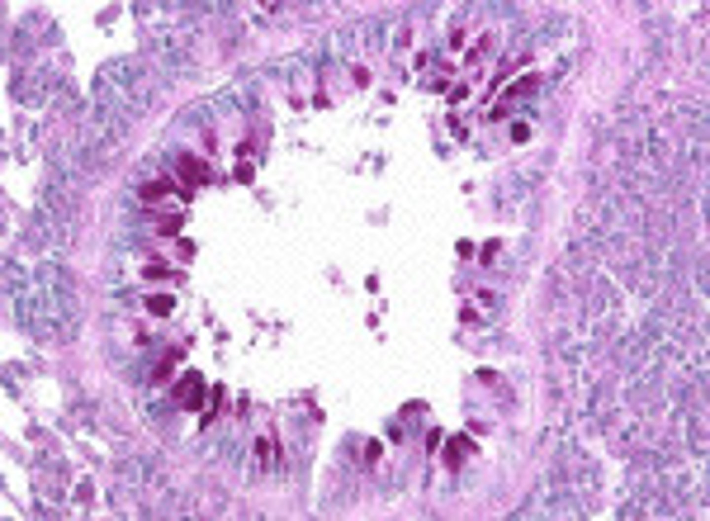 <p>neutral mucin, glycogen</p>
