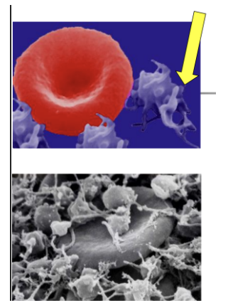 <ul><li><p style="text-align: justify;"><em>Thrombocyta</em></p></li><li><p style="text-align: justify;"><span style="background-color: transparent;">Lemez alakú</span></p></li><li><p style="text-align: justify;"><span style="background-color: transparent;">Átmérő: <strong>1-3 μm</strong> (mikrométer)</span></p></li><li><p style="text-align: justify;"><span style="background-color: transparent;">Szám: <strong>150-300 G/l</strong> (giga/liter)</span></p></li><li><p style="text-align: justify;"><span style="background-color: transparent;">Nincs sejtmag és önálló mozgás</span></p></li><li><p style="text-align: justify;"><span style="background-color: transparent;">Képződés: vöröscsontvelői őssejtek</span></p></li><li><p style="text-align: justify;"><span style="background-color: transparent;">Érés: sejthártyával borított plazmatöredékek</span></p></li><li><p style="text-align: justify;"><span style="background-color: transparent;">Élettartam: kb. <strong>14</strong> nap</span></p></li><li><p style="text-align: justify;"><span style="background-color: transparent;">Pusztulás: lépben, vérrögképződéskor</span></p></li><li><p style="text-align: justify;"><span style="background-color: transparent;">Funkció: véralvadásban a III. faktort tartalmazza</span></p></li></ul><p></p>