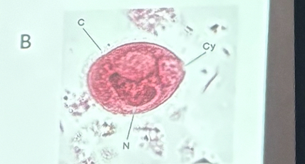 <p>What is this organism?</p>