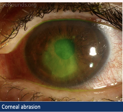 <p>Describe and give diagnosis</p>