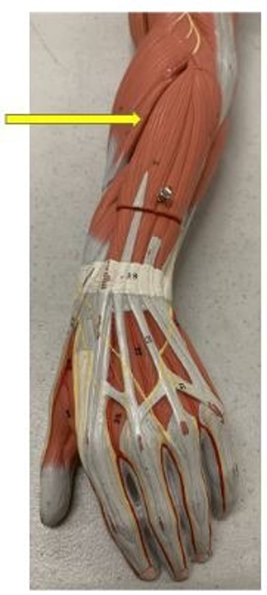 <p>extends and abducts wrist</p>