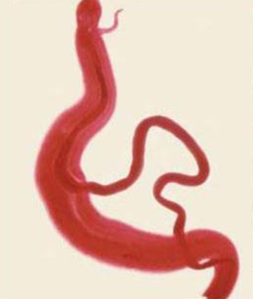 <p><span style="background-color: transparent;"><span>Digenean reproduction</span><em><span> - Schistosoma</span></em><span> (blood fluke) What is th</span></span><span style="background-color: transparent; color: rgb(255, 255, 255);"><span>e GYNECOPHORAL CANAL?</span></span></p>