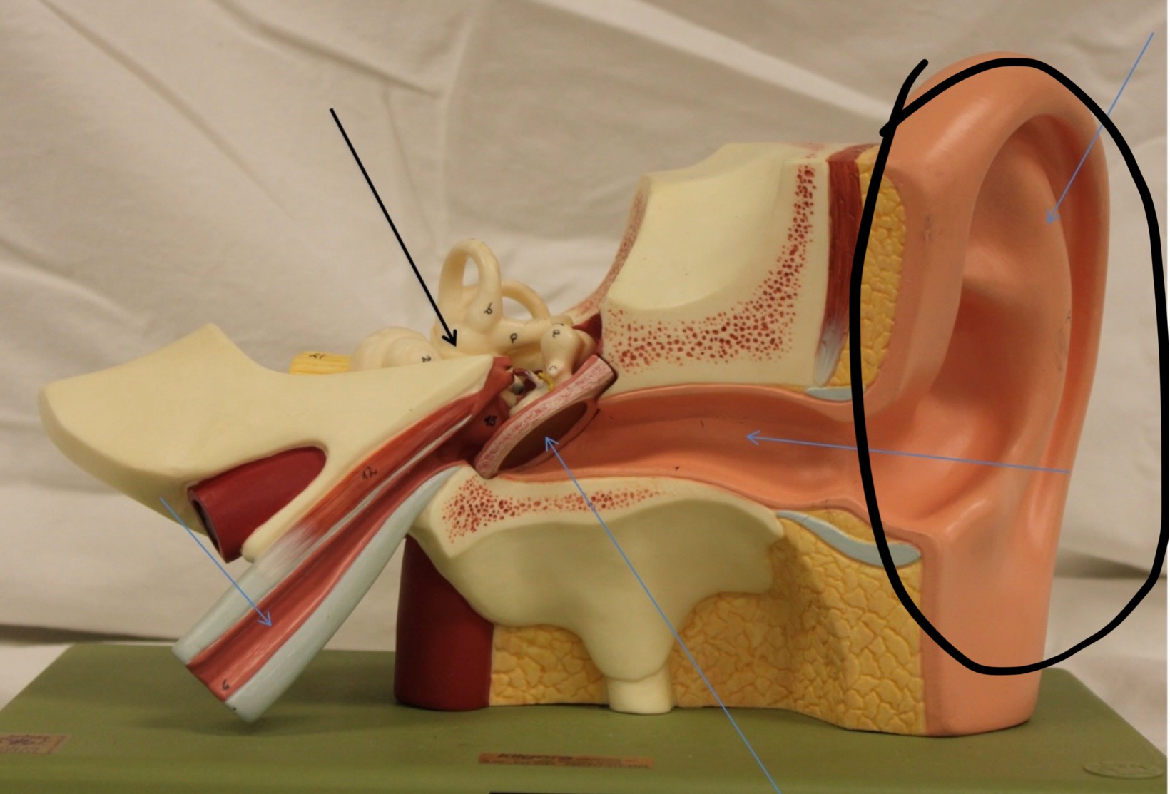 <p>Identify the circled area?</p>