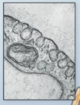 <p>type of Endocytosis</p><p>Little caves → 50-80 nm</p><p>important in endothelial cells</p>