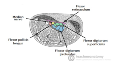 <p>4x tendons of flexor digitorum profundus</p><p>4x tendons of flexor digitorum superficialis</p><p>Tendon of flexor pollicis longus</p><p>Median nerve</p><p>So basically all the long flexors, and the median nerve.</p><p>Diagram shows left.</p>