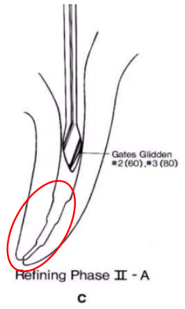 <p>refining phase </p><p>gates glidden #2,3,4 are used to create coronal and middle preparations</p>