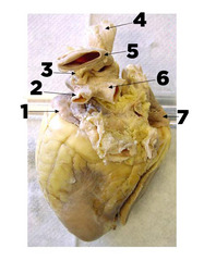 <p>What are #2 and 6?</p>