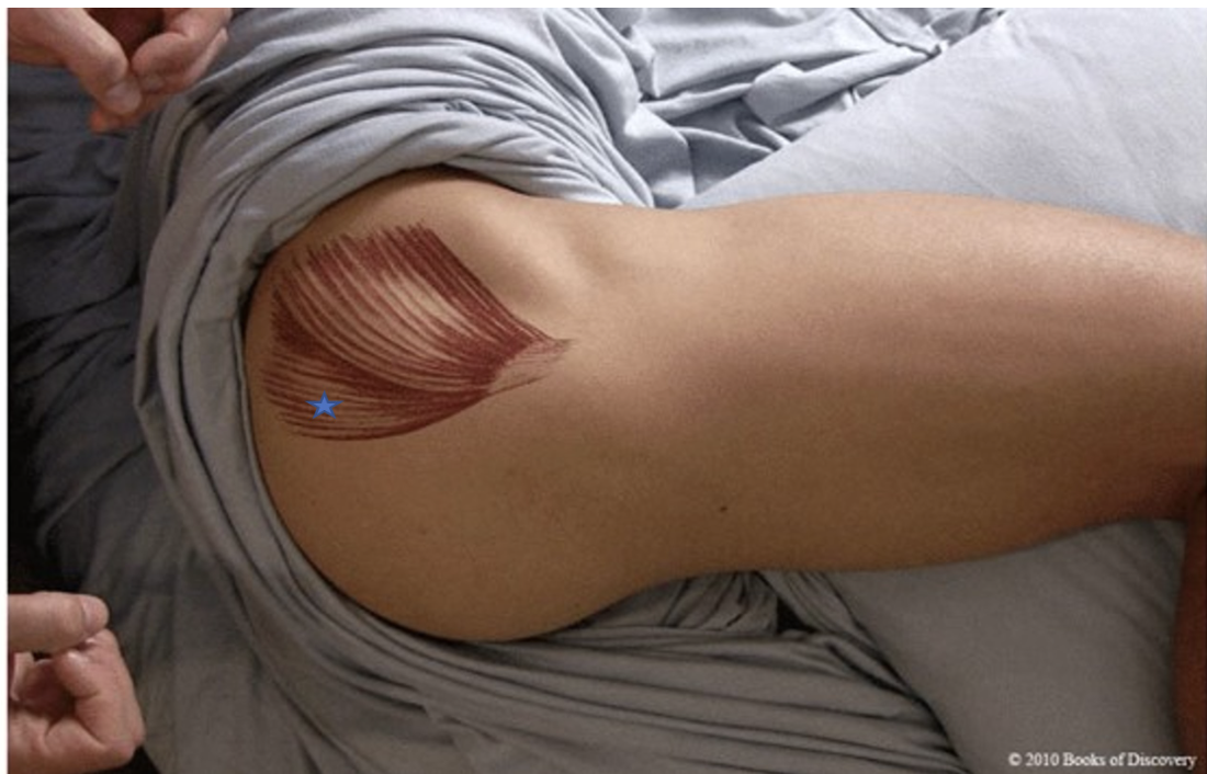 <p><span>From the list of muscles and actions below, identify the "starred" muscle and its primary actions.</span></p>