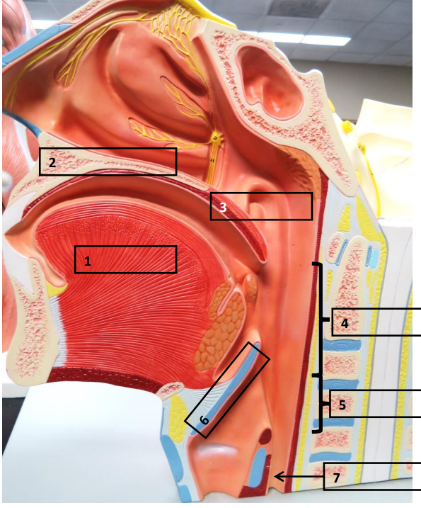 <p>Label this image.</p>