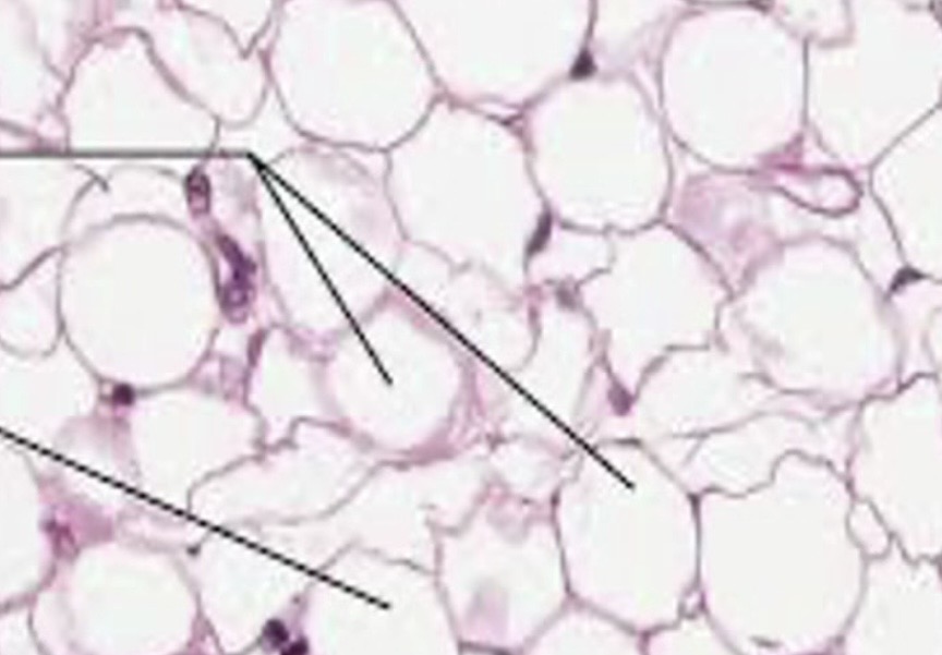 <p>What connective tissue is this? </p>