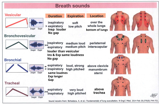 <p>duration→inspiratory sounds equal length to expiratory sounds (inspiratory=expiratory)</p><p>intensity→intermediate</p><p>pitch of expiratory sound→intermediate</p><p><u>locations where heard normally</u></p><ul><li><p>anteriorly</p></li><li><p>often in the 1st+2nd interspaces</p></li><li><p>between the scapulae</p></li></ul><p></p>
