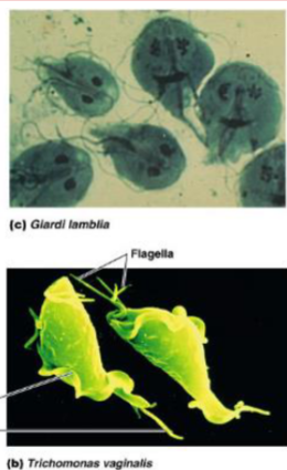 <p>The protozoa responsible for causing <strong><mark data-color="purple" style="background-color: purple; color: inherit;">giardiasis</mark></strong>: gastrointestinal infection → <mark data-color="yellow" style="background-color: yellow; color: inherit;">very contractive diarrheal illness </mark>that is often asymptomatic</p><ul><li><p>forms cyst that is shed in feces of animals and humans, which contaminates water that could be drunk</p></li></ul><ul><li><p>symptoms (if they occur) are <mark data-color="yellow" style="background-color: yellow; color: inherit;">foraminating (foamy/gassy) diarrhea → “explosive diarrhea”</mark></p></li><li><p>can stay with person for <mark data-color="yellow" style="background-color: yellow; color: inherit;">30 years</mark></p></li></ul><p></p>