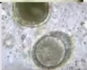 <p>Identify the bottom egg</p>