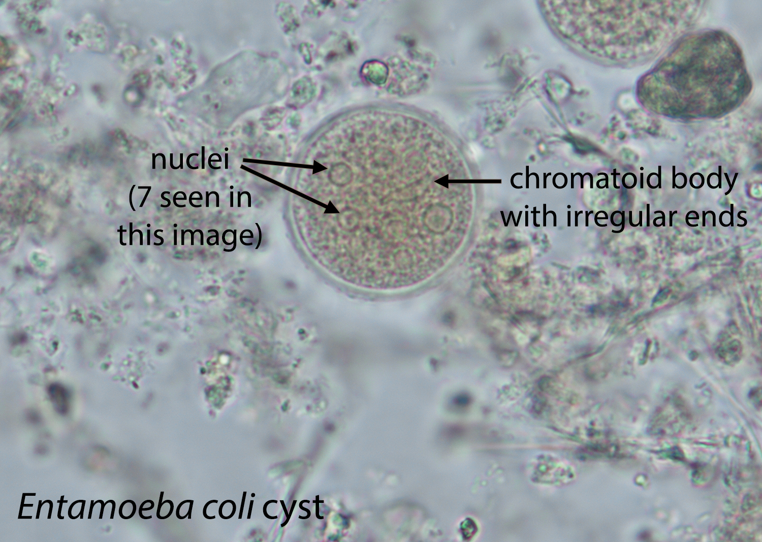 <p>10-35 um, <u>1-8 nuclei</u>, <u>sharp chromatoidal bars</u>, eccentric karyosome, irregular PC, granular cytoplasm</p>