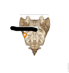 <p>What Boney Feature?</p>