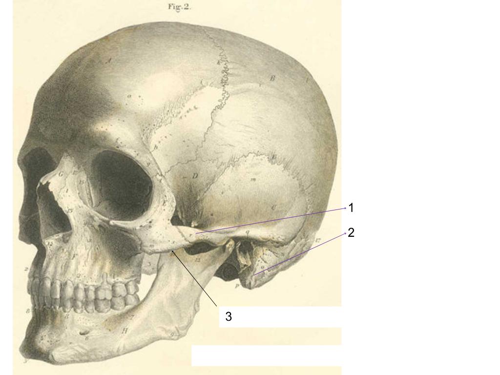 <p>what is #2 pointing at?</p>
