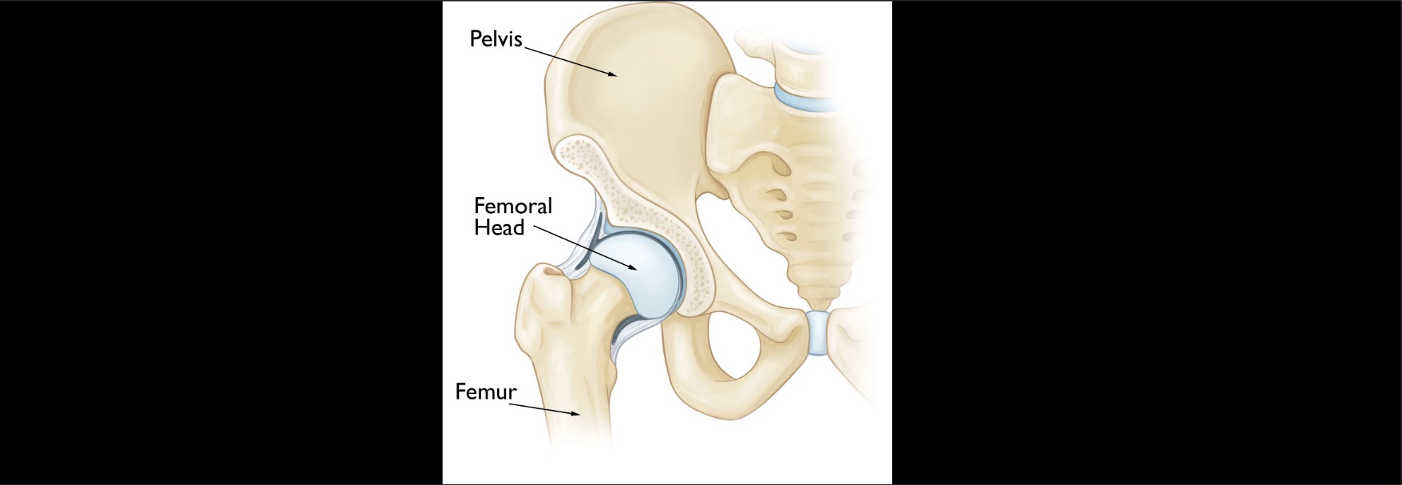 <p>Rounded portion of ball and socket joint</p>