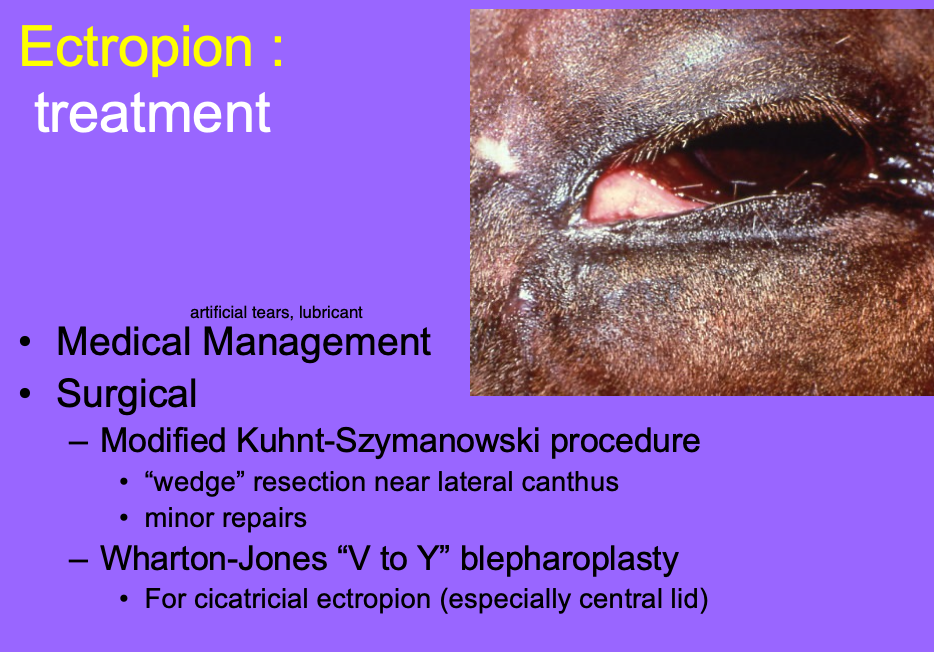 <p>Medical management.</p><p>Surgical.</p>