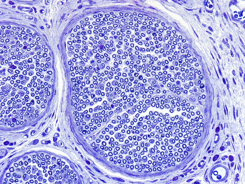 <p>Typically no neuron bodies, nuclei usually Schwann cells; similar look to connective tissue and smooth muscle but lighter stain, look for PNS connective tissue/organization</p>