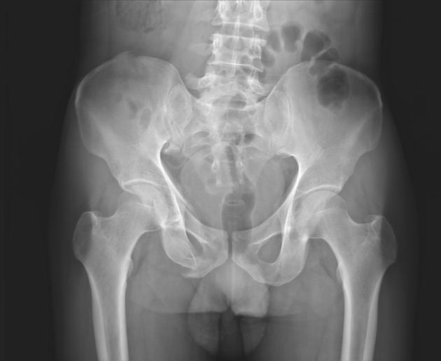 <p>What is the diagnosis?</p>
