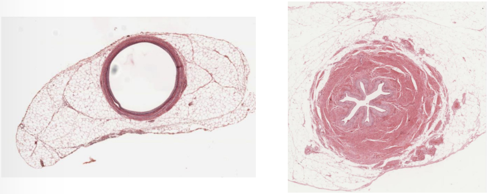 <p>What organ is represented in the picture?</p>