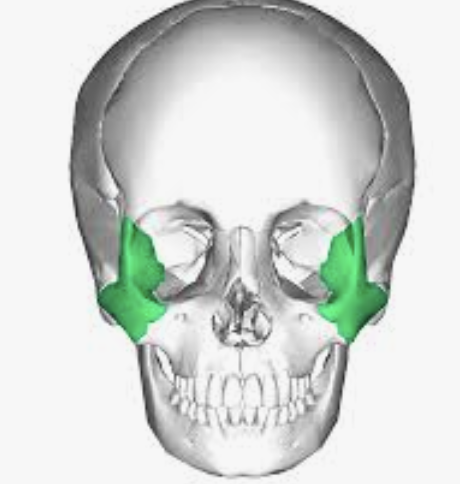 <p>Which bone is this?</p>