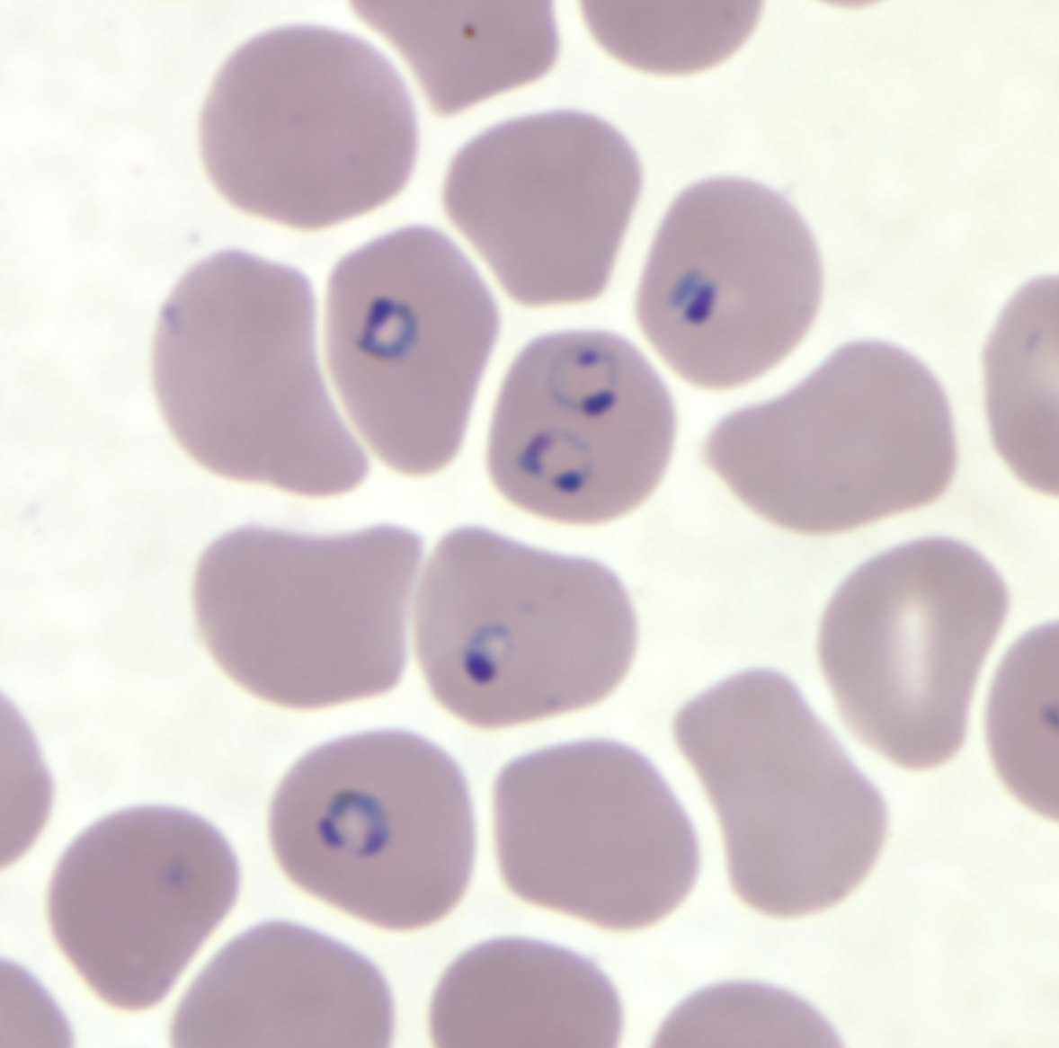 <p>What parasite is this?</p>