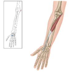 <p>What is the insertion for the flexor carpi radialis?</p>
