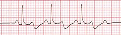 <p>identify the rhythm</p>