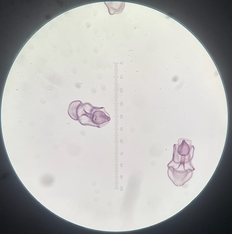 <p>bipinnaria larvae</p>
