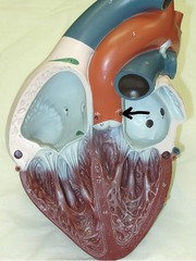 <p>Identify this blood vessel starting here (be specific).</p>