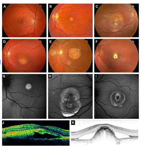<p>Name the condition</p>