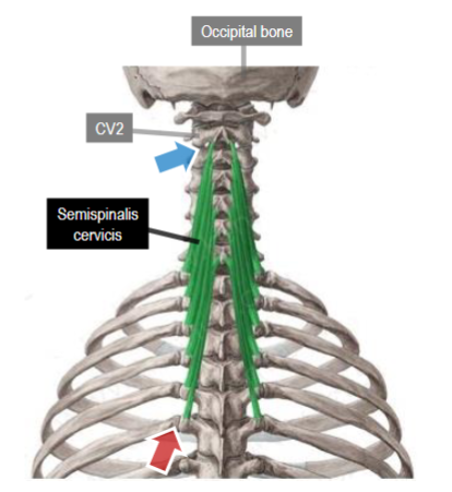 <p>Origin: transverse processes of upper TVs</p>
