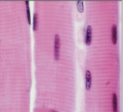 <p>What kind of muscle is this?</p>