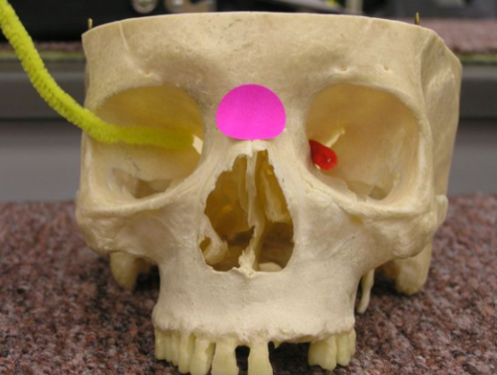 <p>Identify the bones labeled with the pink dot. </p>