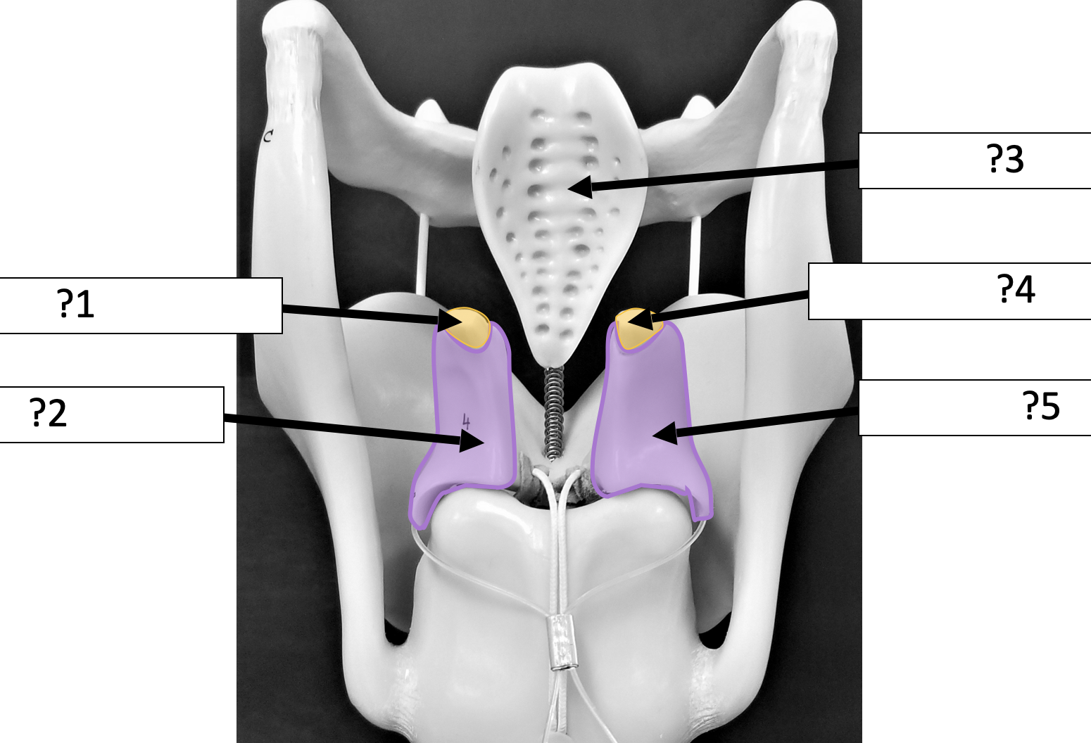 <p>4 Name the structure? </p>