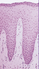 <p>- in gingiva, shows keratin squames that have retained pyknotic nuclei</p><p>- granular layer containing only a few scattered granules</p>