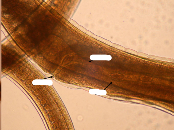 <p>What is this parasite, and what are the structures </p>