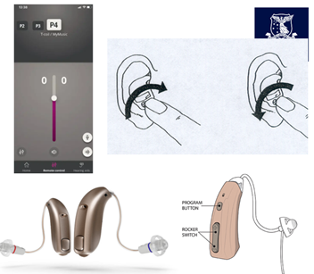 <p>how is volume controlled in hearing aids?</p>