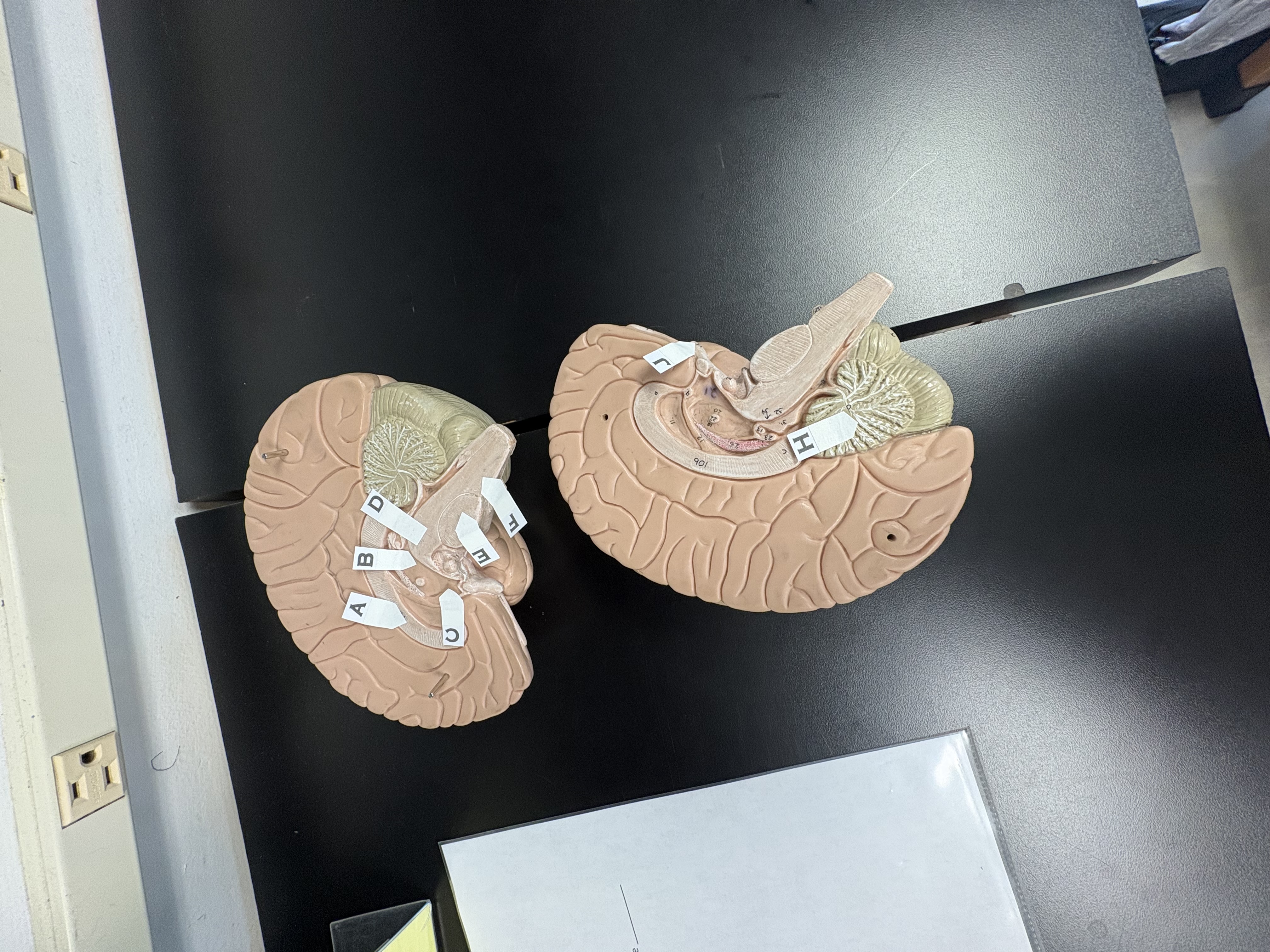 <p>F. identify this stucture of the brainstem</p>