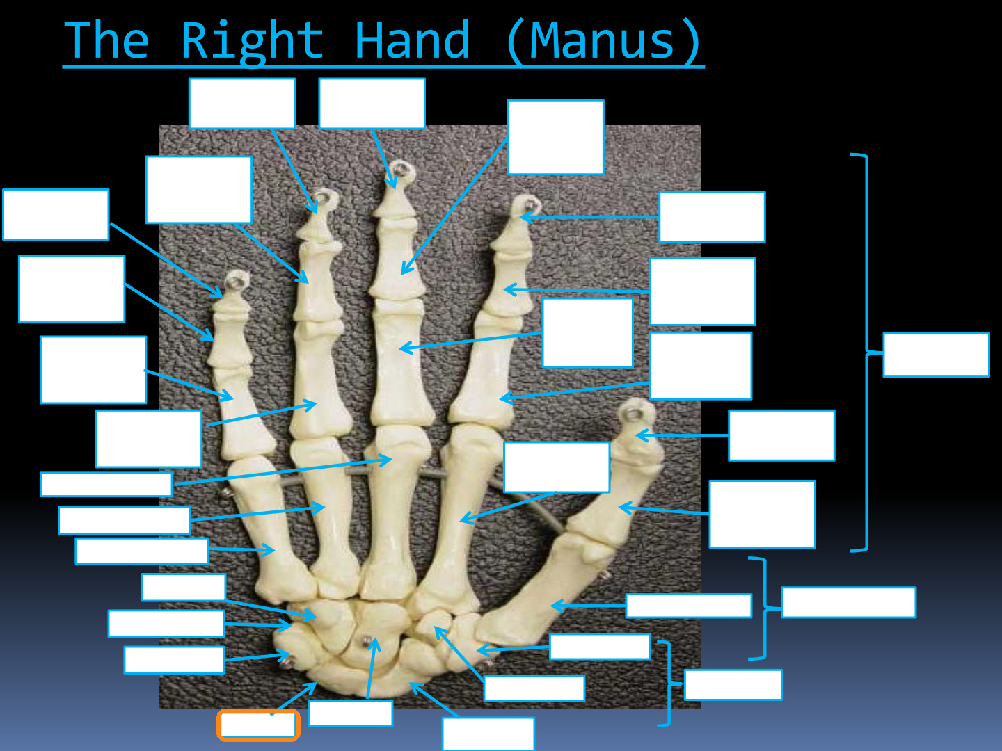 <p>Identify the highlighted structure in the Right Hand (Manus): Carpals diagram.</p>