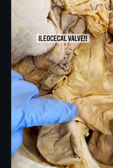 <p>what is this structure on the small intestine </p>