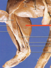 <p>what is the red line pointing to?</p>