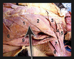 <p>muscle that acts with the superficial muscles of the ventral chest to rotate the forelimb and to draw the forelimb toward the chest</p>