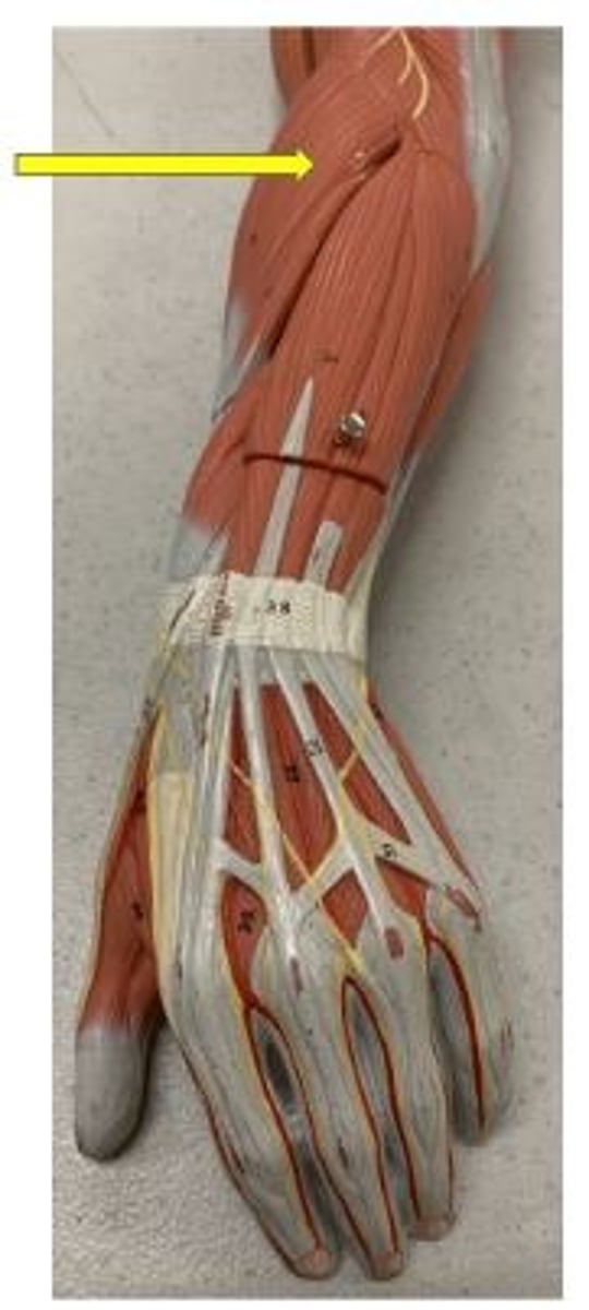 <p>extends and abducts wrist</p>